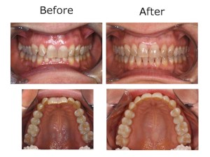 Before and after dental work